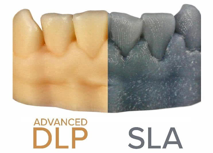 dlp vs sla surface finish comparison