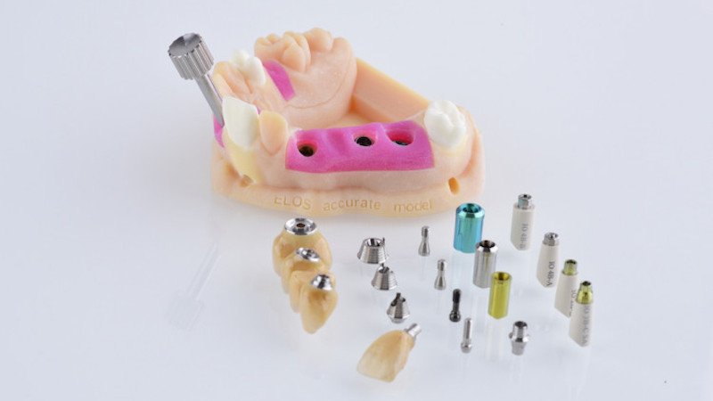 3d printing applications in dental