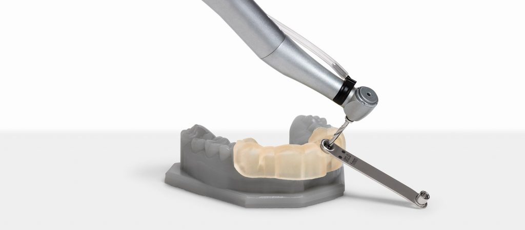 3d printed dental implant