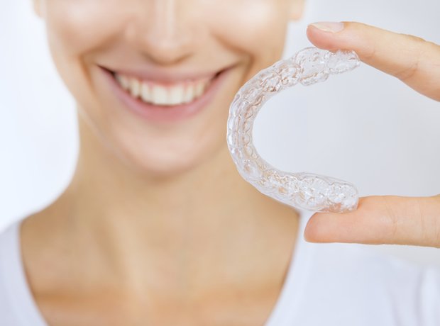 dental 3d printed retainer