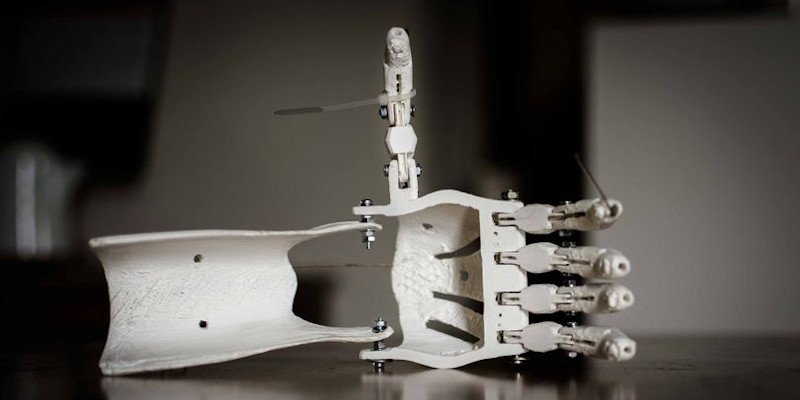 uses of 3d printing in prosthetics